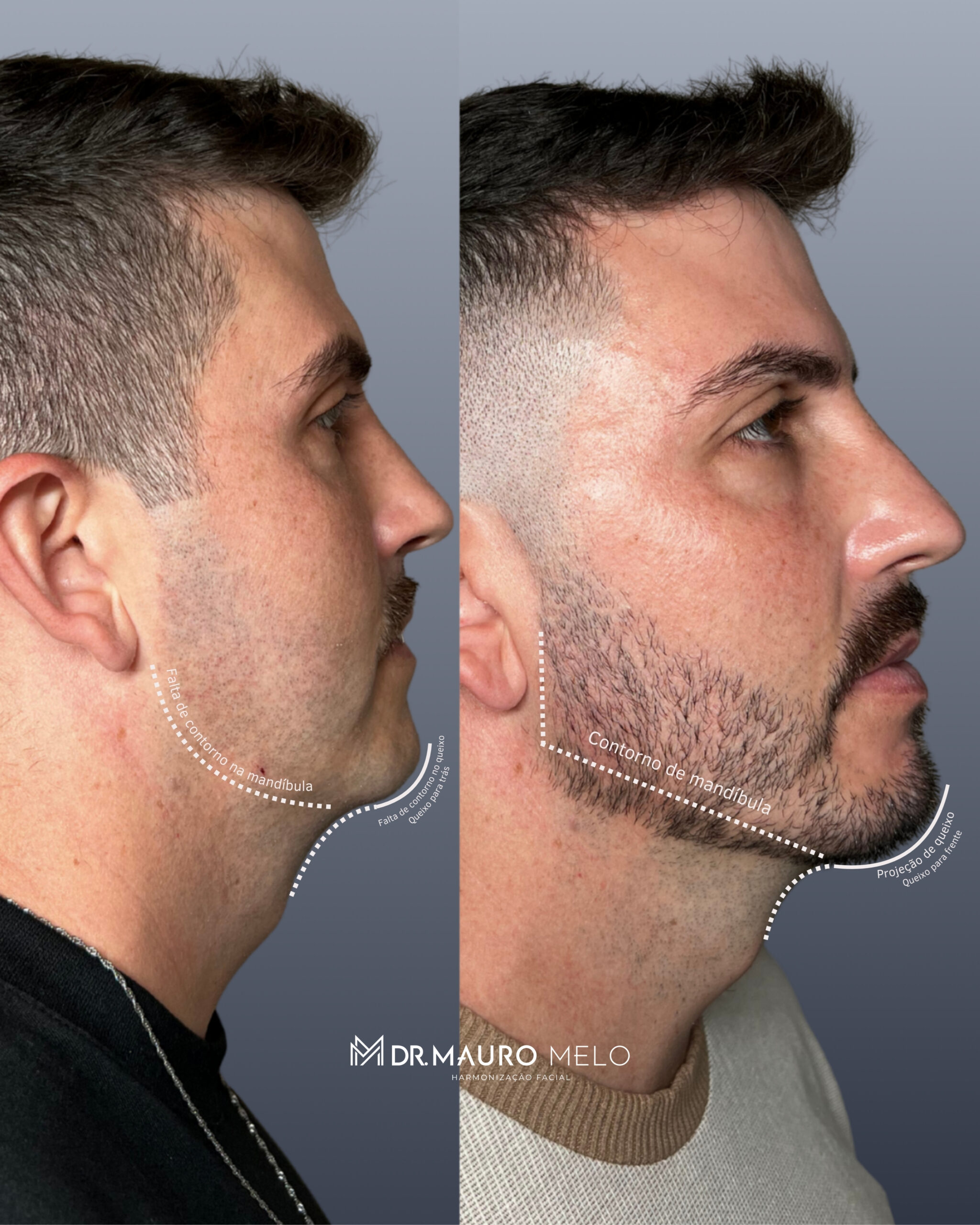 Texto do seu parágrafo - 6